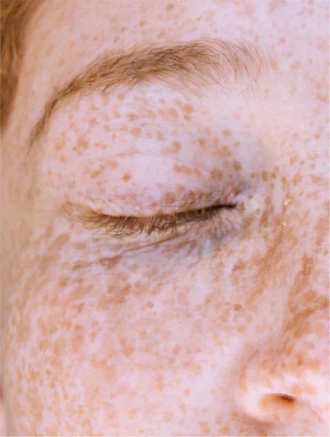 Dark Spot Face Cream with Kojic Acid - Lueur Beauté
