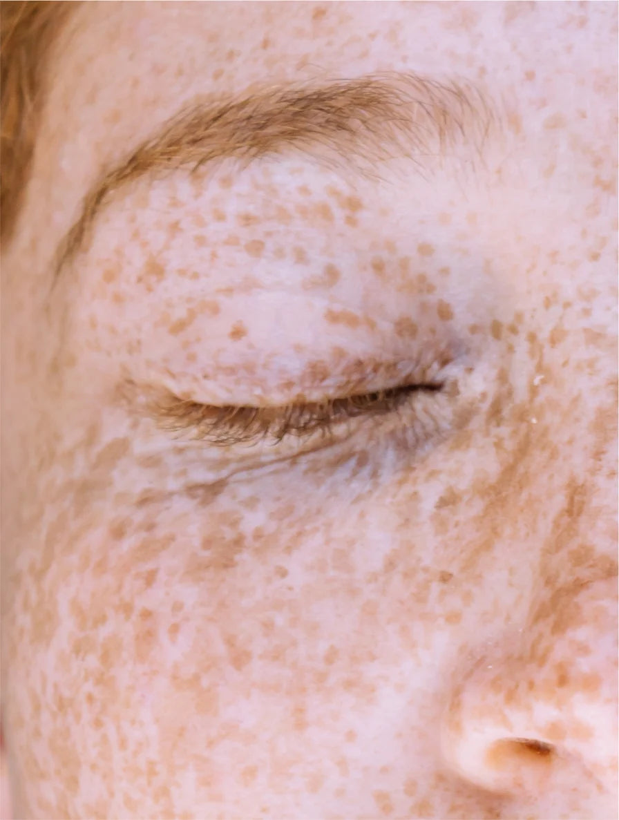 Dark Spot Routine Duo targeting uneven skin tone and visible dark spots for clearer-looking skin