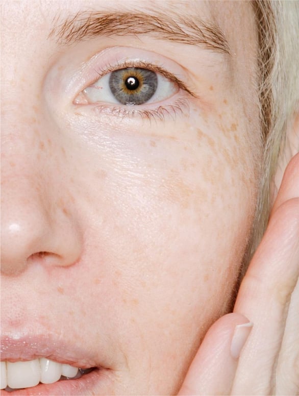 Hydrating face mist with prebiotics on healthy glowing skin suitable for sensitive and dehydrated skin