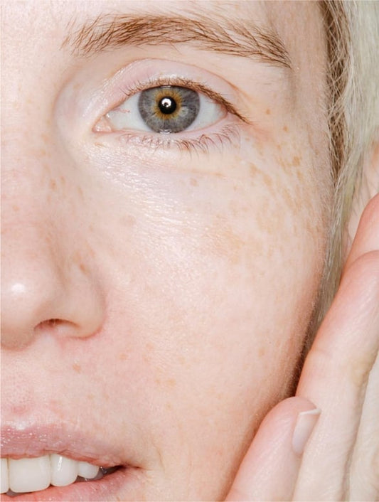 Hydrating face mist with prebiotics on healthy glowing skin suitable for sensitive and dehydrated skin