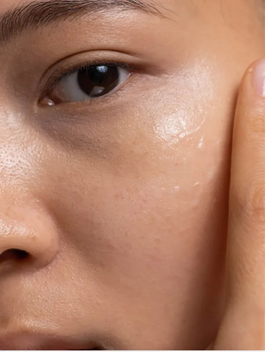 Applying niacinamide gel moisturiser on face for hydration and brighter skin tone